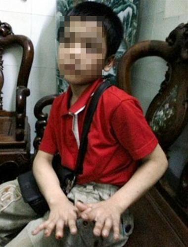 Nghi án 4 trẻ nhỏ bị hành hạ dã man tại nhà trọ