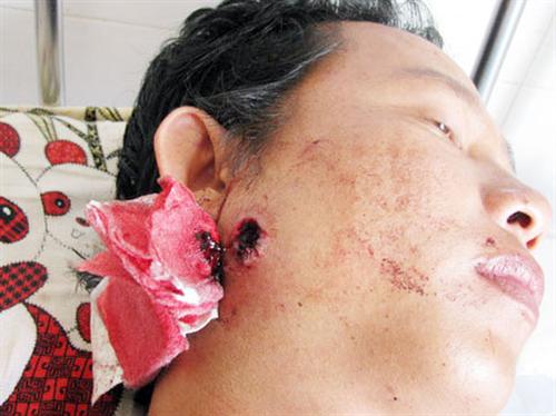 Nam thanh niên trúng đạn tại đồn công an