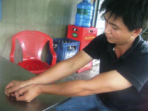 “Ghét” đàn ông, khỉ 3 chân tấn công nhiều người