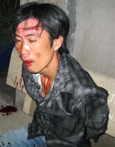 “Hiệp sĩ” bắt gọn tên cướp sau 10km truy đuổi quyết liệt