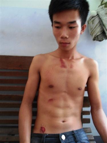 Một học sinh lớp 12 bị cảnh sát cơ động đạp vào ngực?