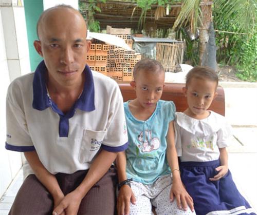 Lạ lùng gia đình “trọc đầu” qua 3 thế hệ