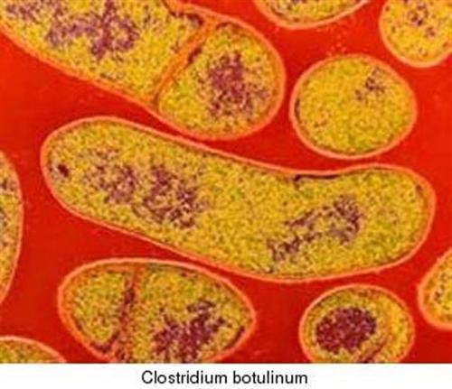 Tránh ngộ độc do vi khuẩn C. Botulinum, cách nào?