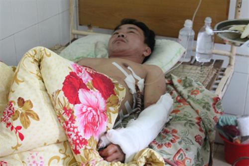Một lái xe bị bắn xuyên thành ngực