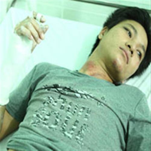 Bị CA đánh gãy tay vì không đội mũ BH?